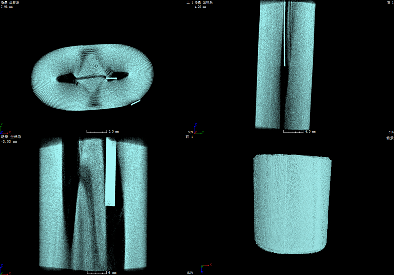 FDK_Slice_0000 1_副本.jpg